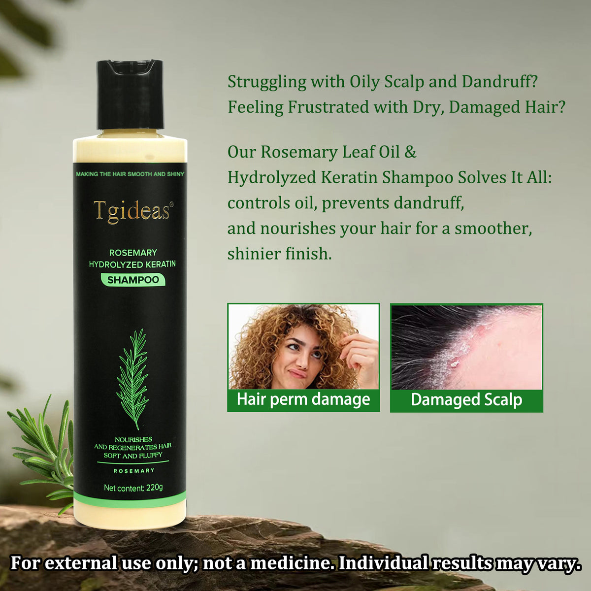 Tgideas® Rosemary Shampoo | Hair Growth & Anti-Dandruff Scalp Treatment