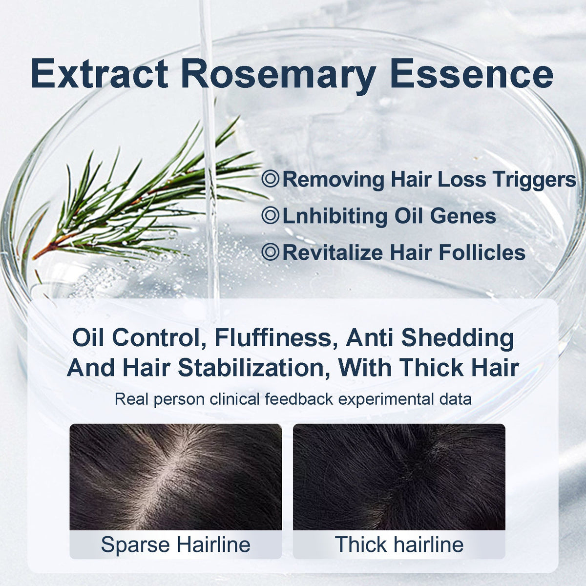 Tgideas® Caviar & Rosemary Shampoo: Volumizing & Oil Control Formula-zrl