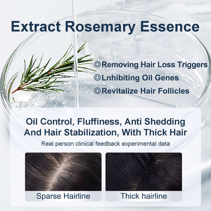Tgideas® Caviar & Rosemary Shampoo: Volumizing & Oil Control Formula