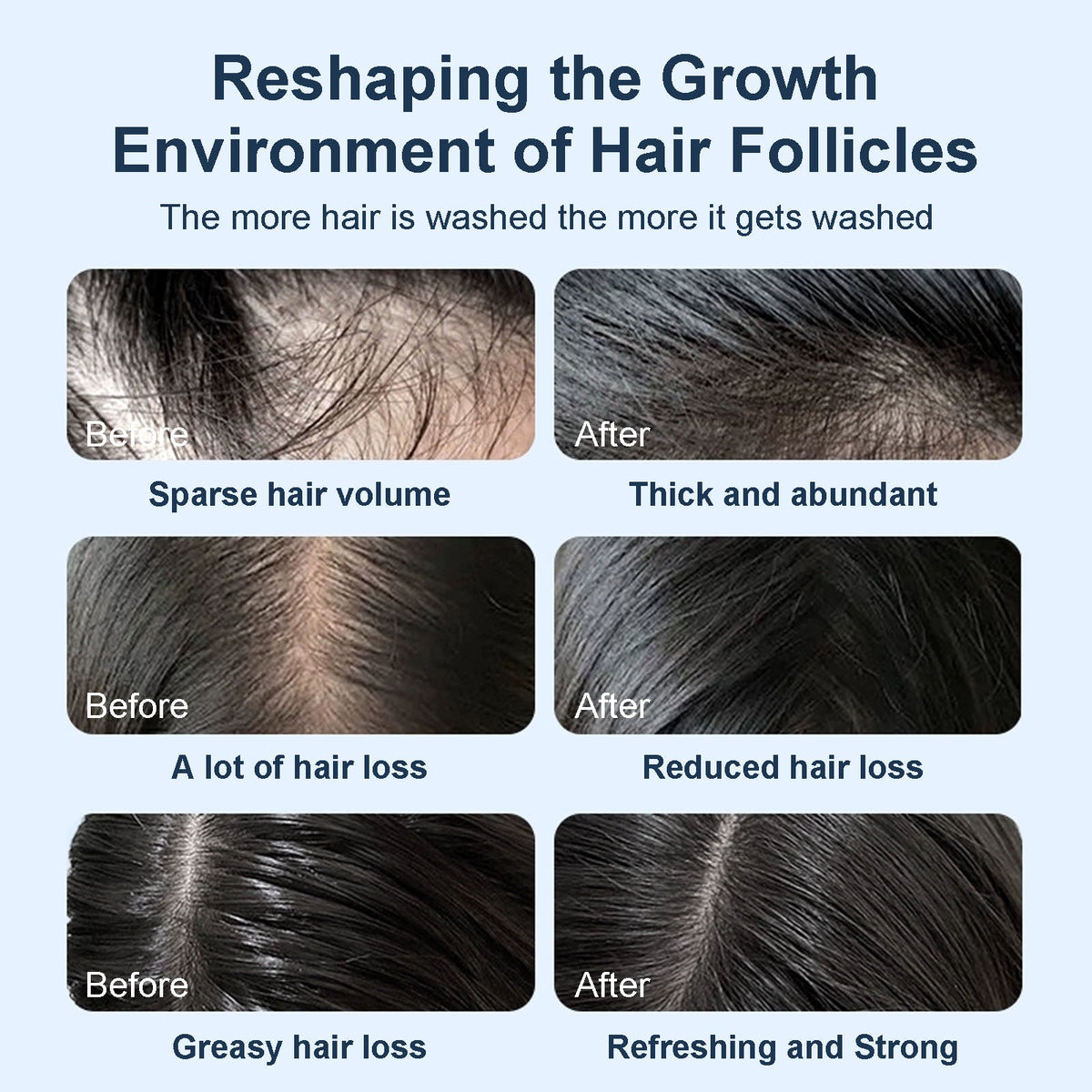 Tgideas® Caviar & Rosemary Shampoo: Volumizing & Oil Control Formula-zrl