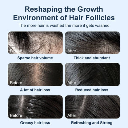 Tgideas® Caviar & Rosemary Shampoo: Volumizing & Oil Control Formula-zrl